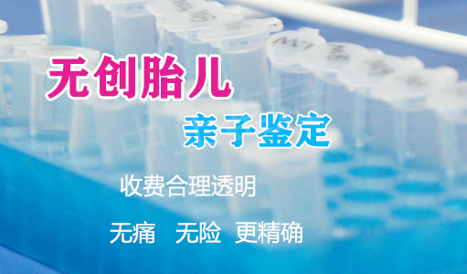 天津胎儿亲子鉴定如何办理,天津产前亲子鉴定结果准不准确 天津胎儿亲子鉴定如何办理,天津产前亲子鉴定结果准不准确